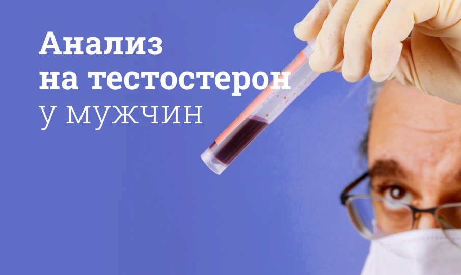 Анализ на тестостерон у мужчин