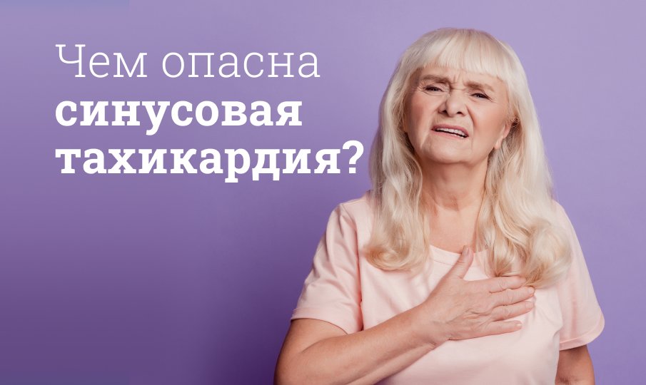 Синусовая тахикардия