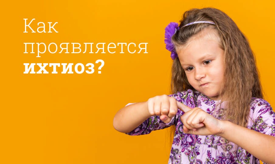 Как проявляется ихтиоз?
