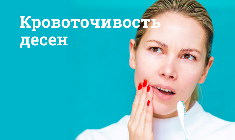 Причины кровоточивости десен