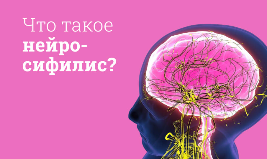 Что такое нейросифилис?