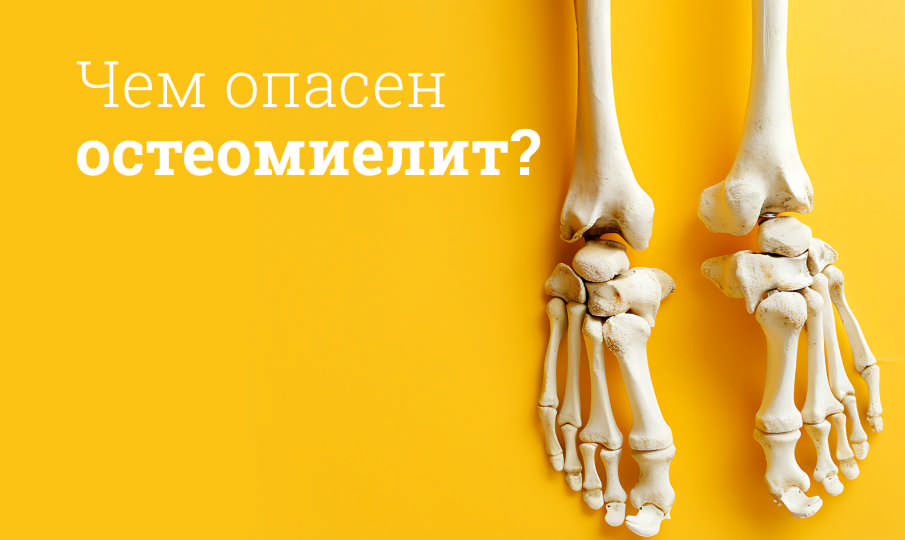 Лечение остеомиелита