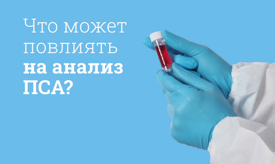 Что нельзя делать перед сдачей анализа крови на ПСА?