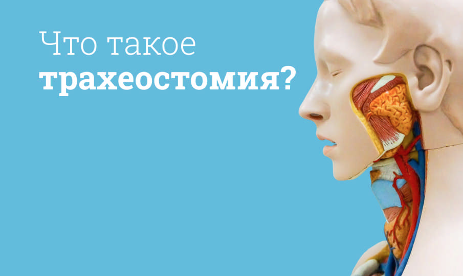 Проведение трахеостомии