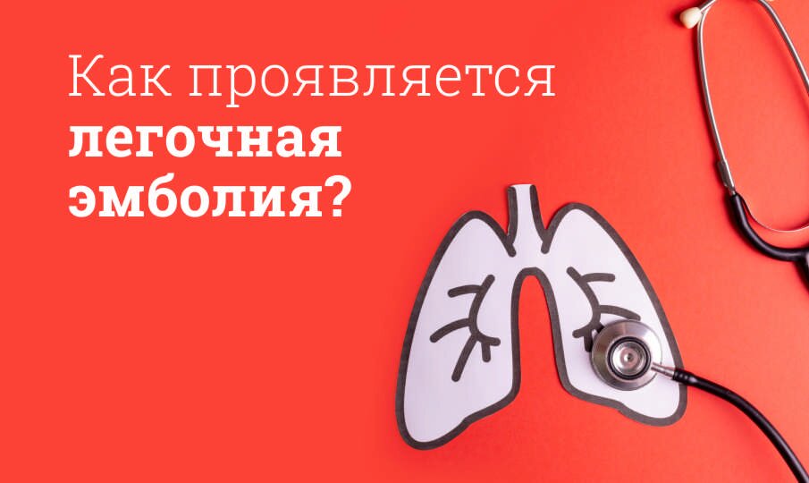 Легочная эмболия