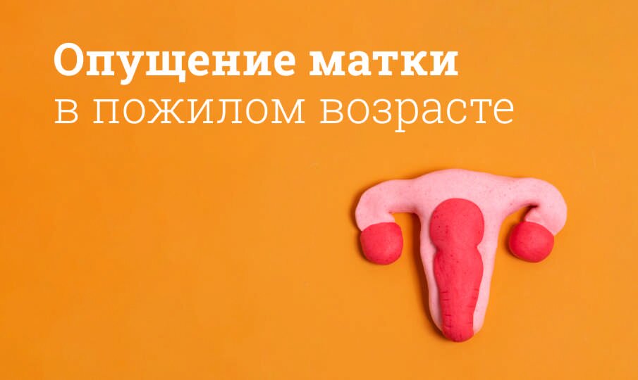 Опущение матки: что делать в пожилом возрасте