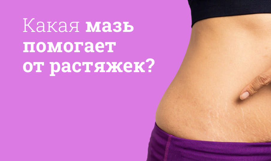 Мази от растяжек
