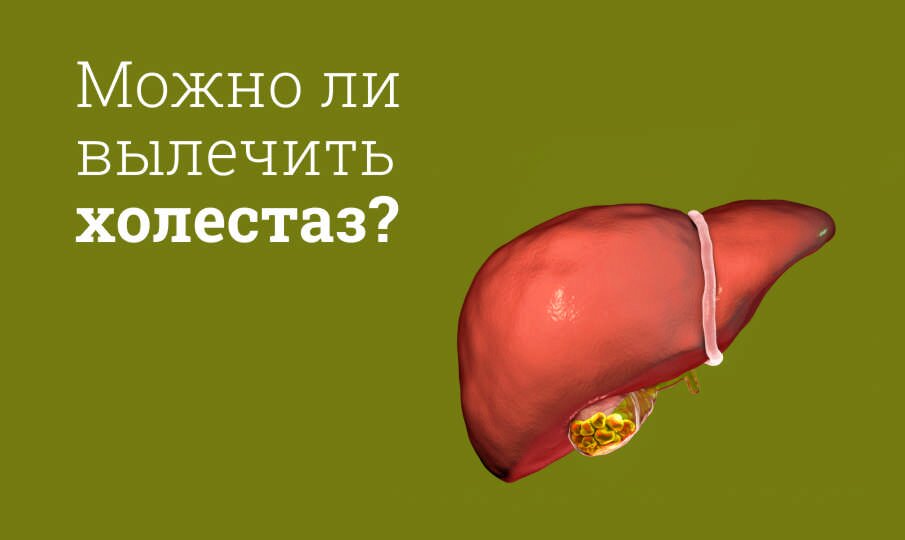 Холестаз: симптомы и лечение