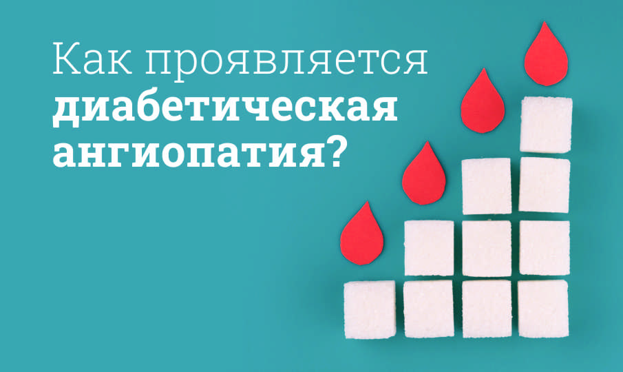 Диабетическая ангиопатия