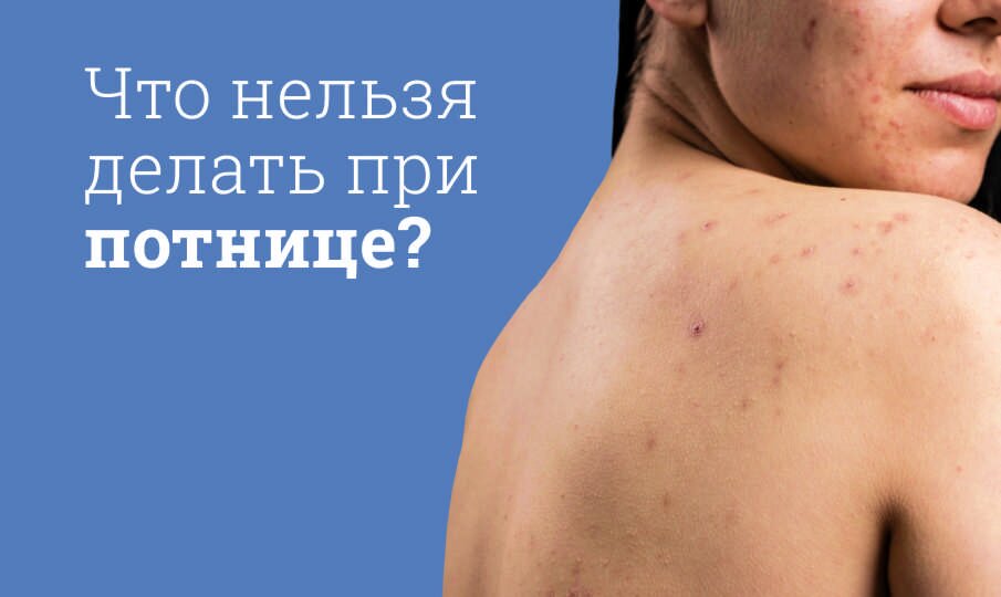 Симптомы и лечение потницы