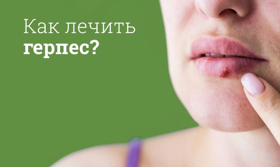 Лечение герпеса