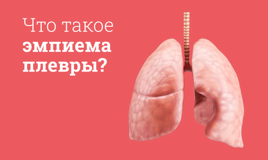 Лечение эмпиемы плевры