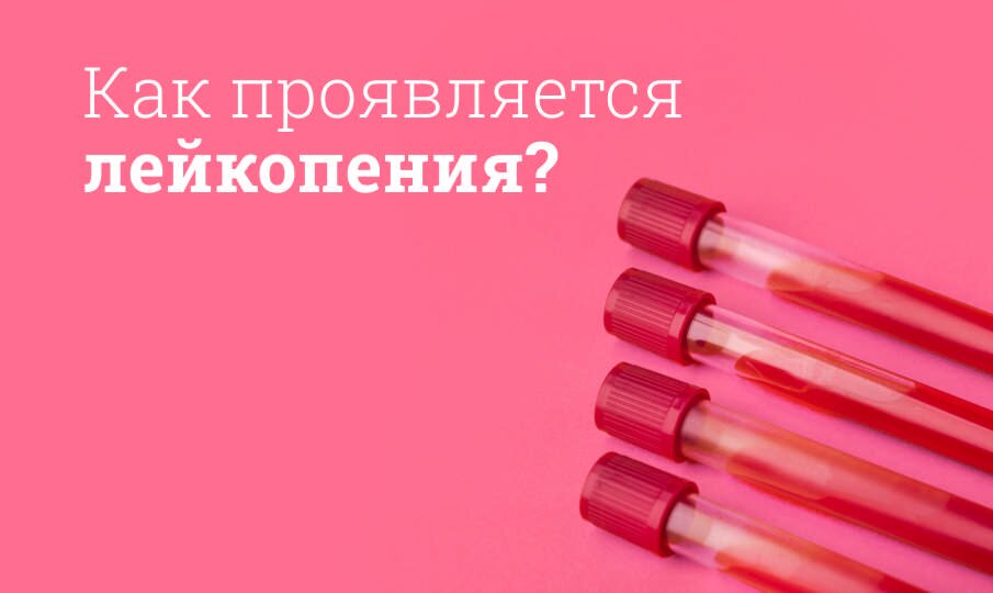 Leukopenie P znaky P iny L ba Stupn A Testy Leukopenie P znaky P iny L ba Stupn A Testy