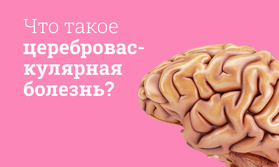 Цереброваскулярная болезнь
