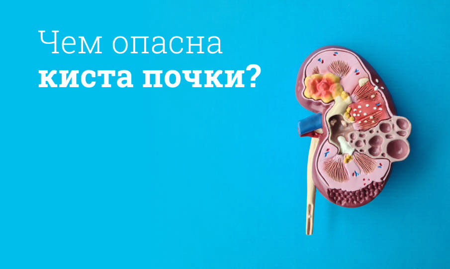 Причины кисты почки