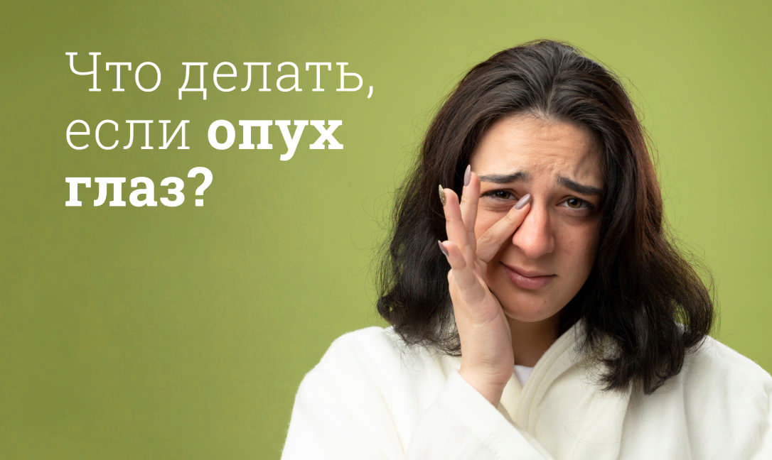 Что делать, если опух глаз?