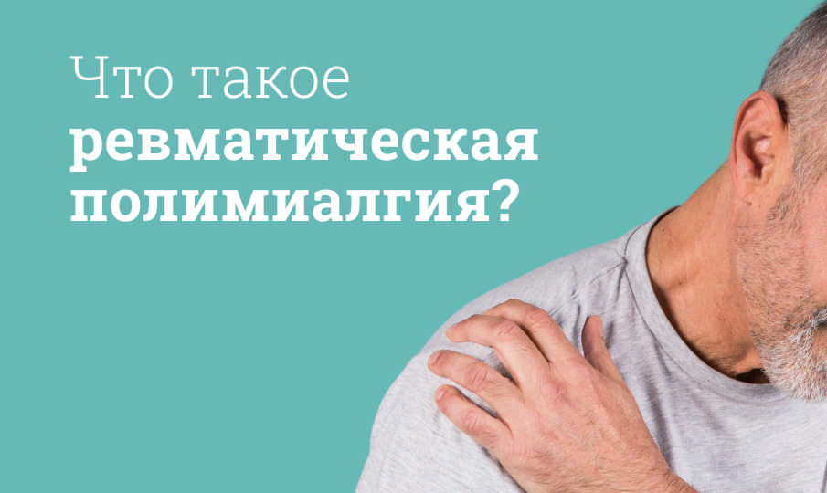 Полимиалгия ревматическая