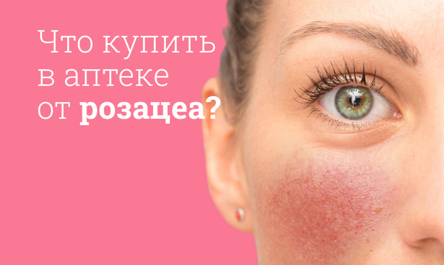 Что купить для ухода при розацеа?
