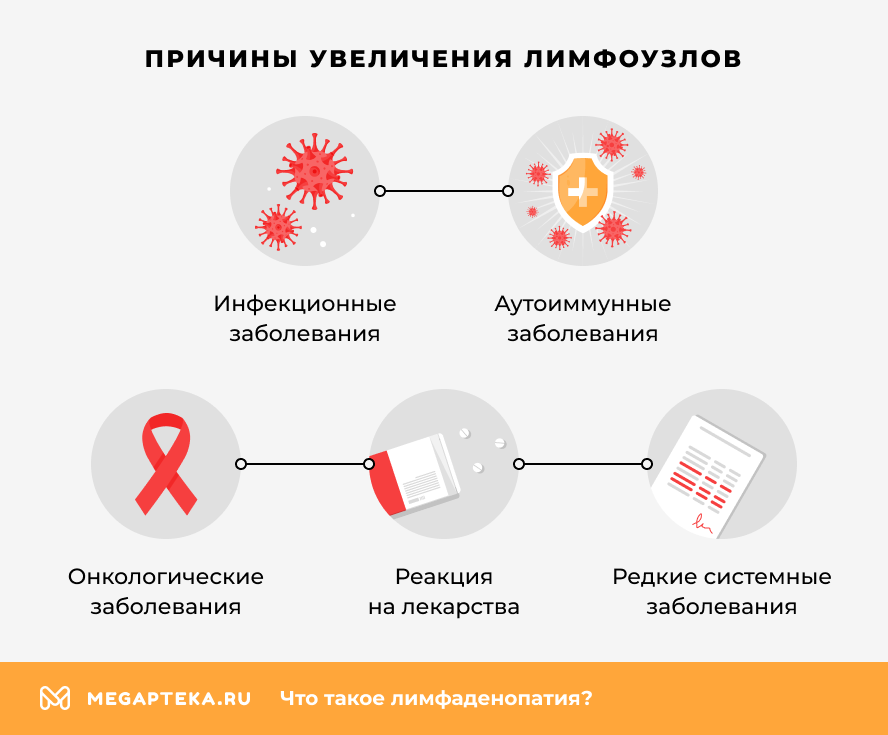 Причины увеличения лимфоузлов