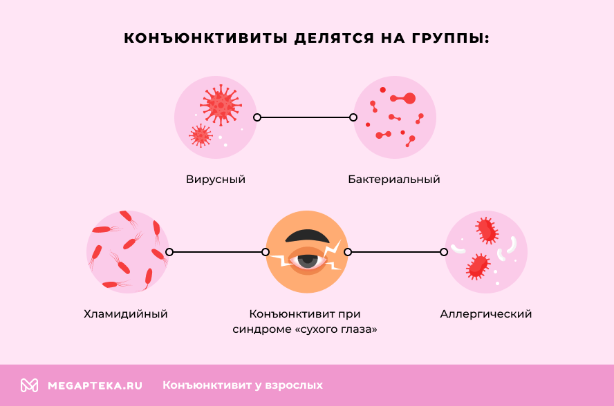 Конъюнктивиты делятся на группы: