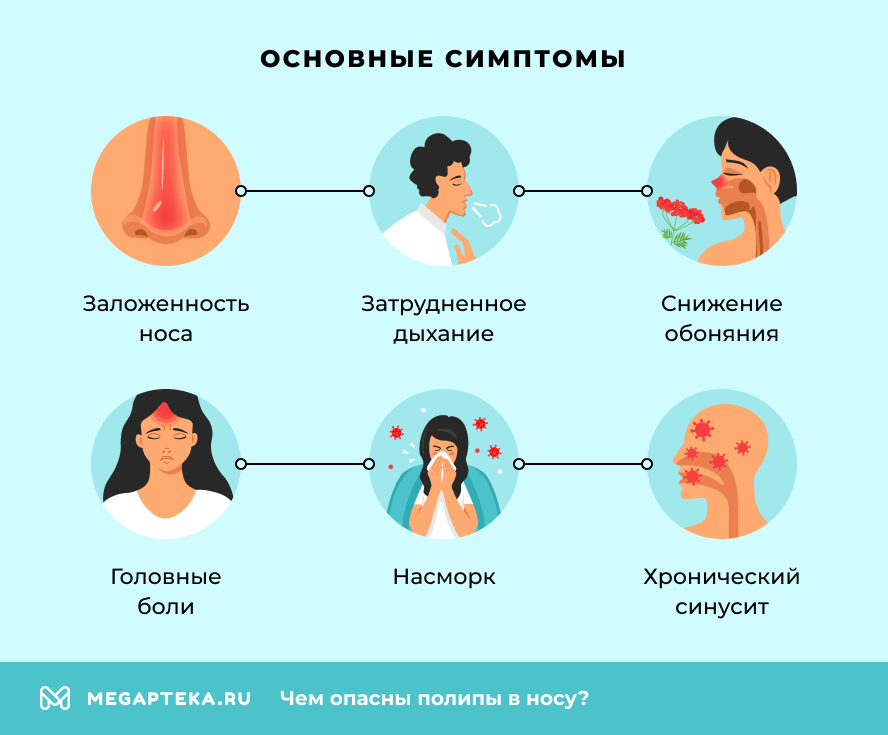 Основные симптомы