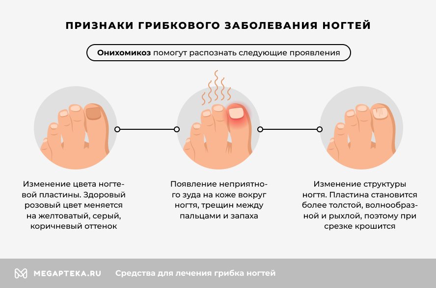 Симптомы и признаки грибка ног