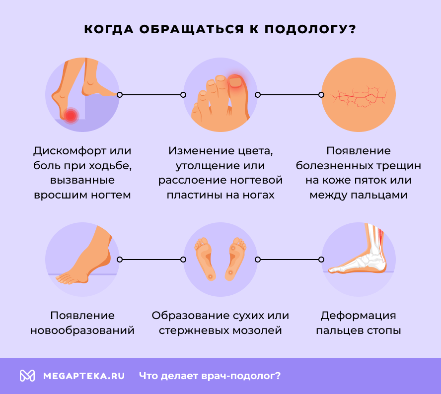 Когда обращаться к подологу?