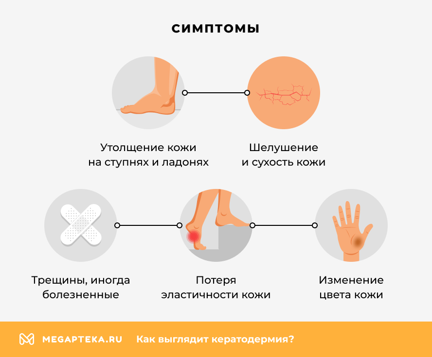 Симптомы