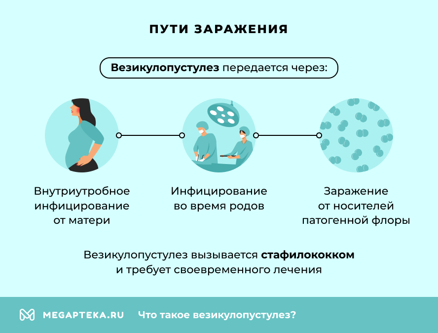 Пути заражения