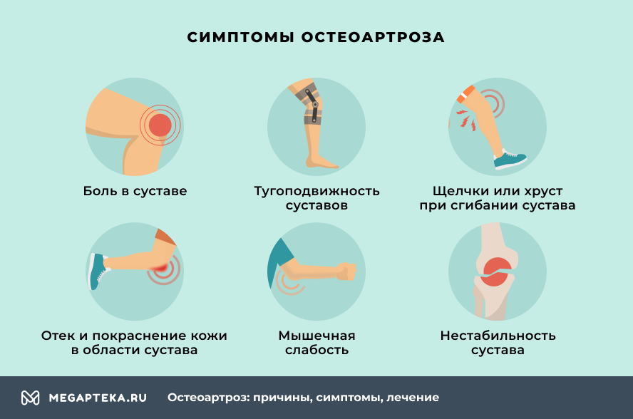 Симптомы остеоартроза