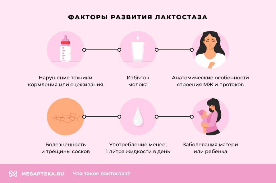 Лактостаз - причины, симптомы, признаки, диагностика, лечение, профилактика