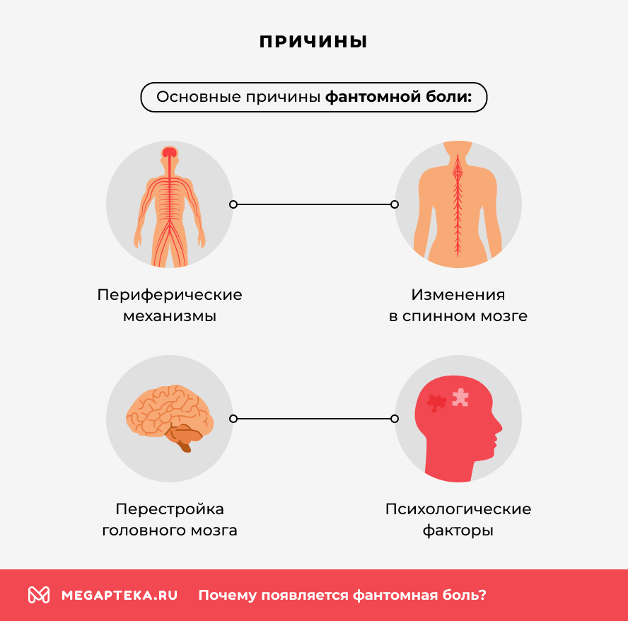 Причины