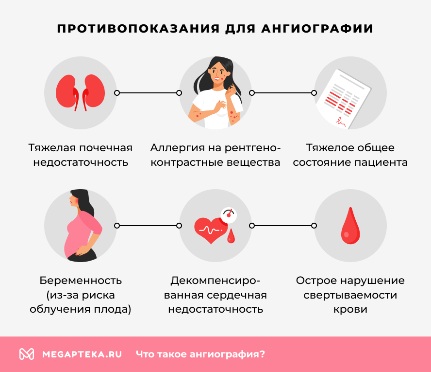 Противопоказания для ангиографии