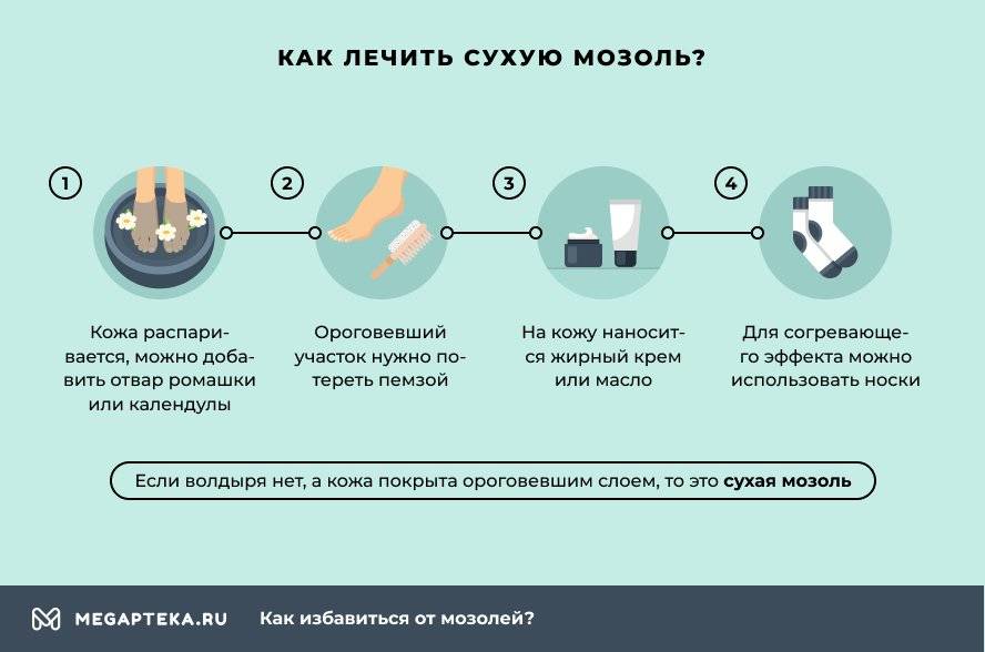 Стержневая мозоль. Удаление и методы лечения