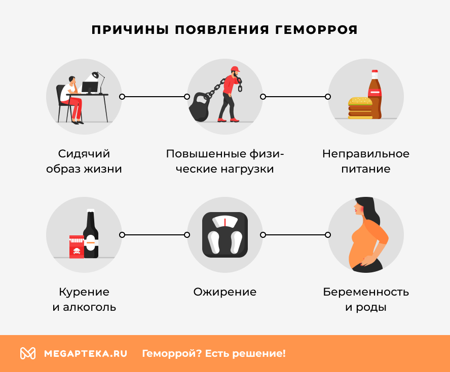 Причины появления геморроя