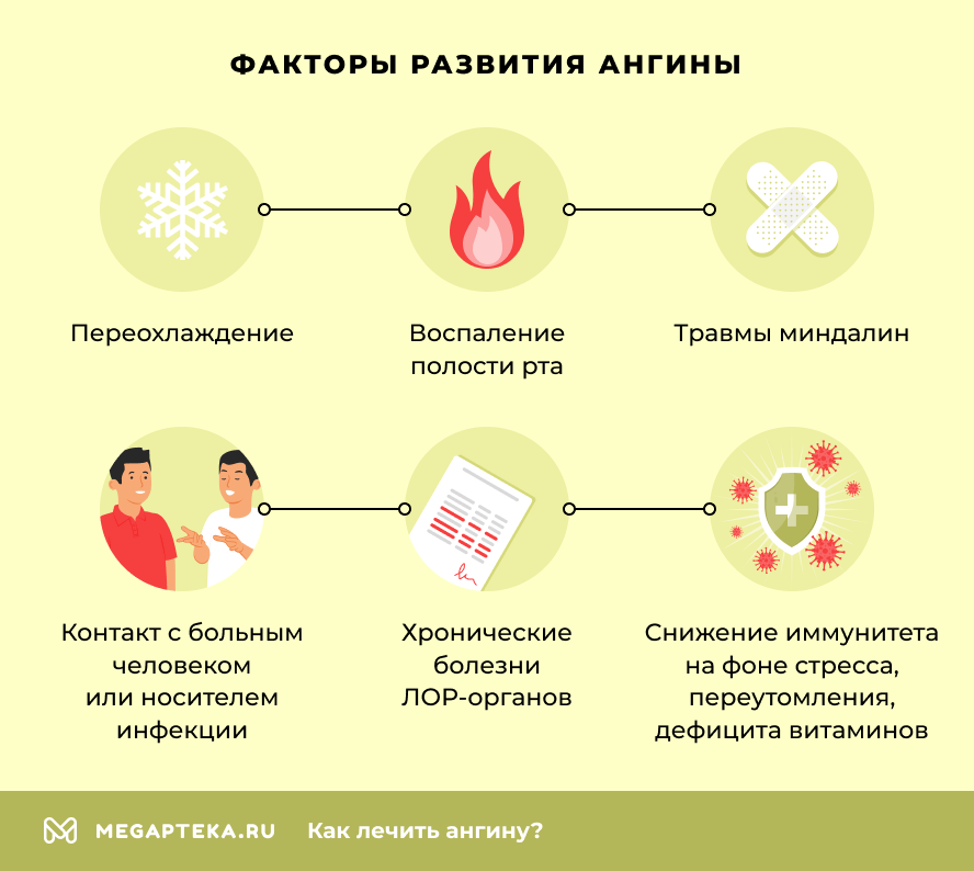Факторы развития ангины
