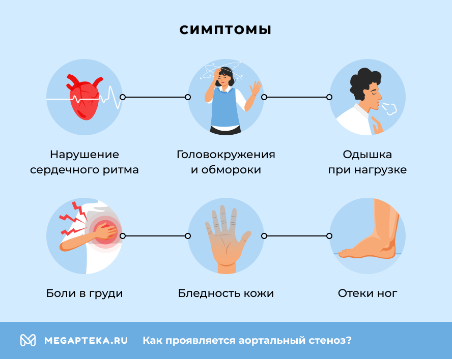 Симптомы