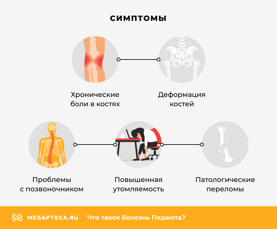 Симптомы