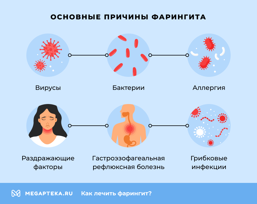 Основные причины фарингита