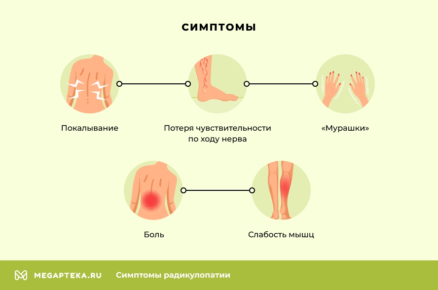 Лечение дискогенного радикулита в Болгарии