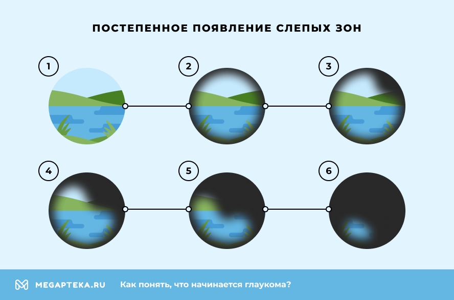 Постепенное появление слепых зон