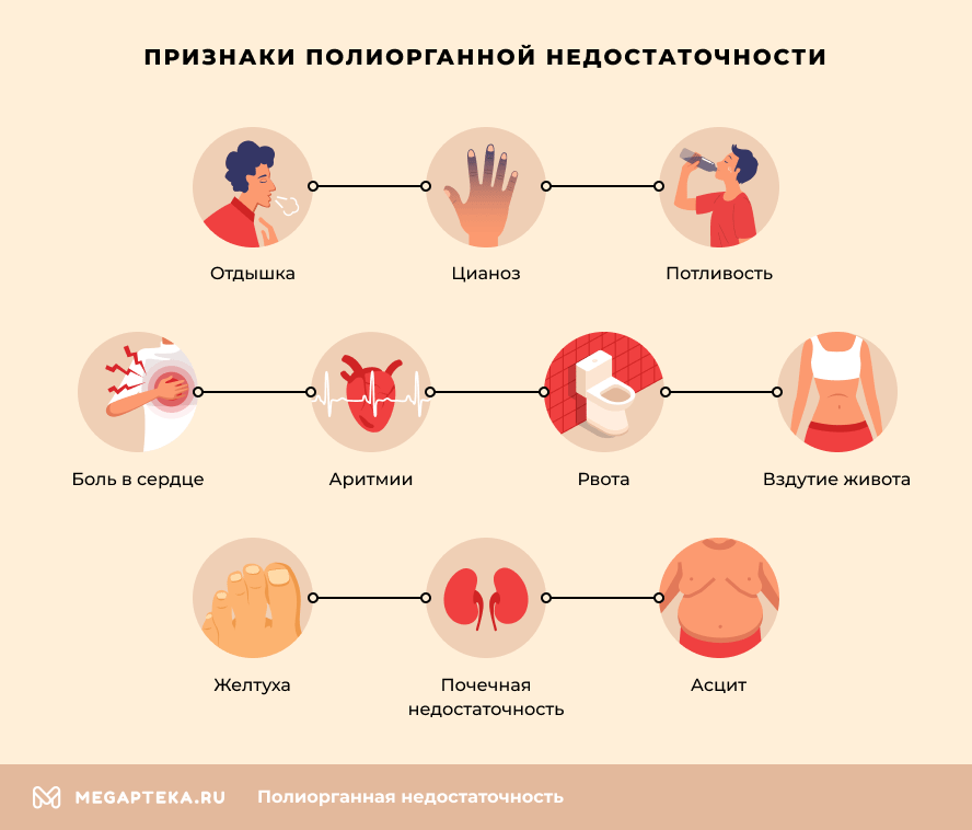 Одышка: симптомы, причины и методы лечения в «СМ-Клиника»