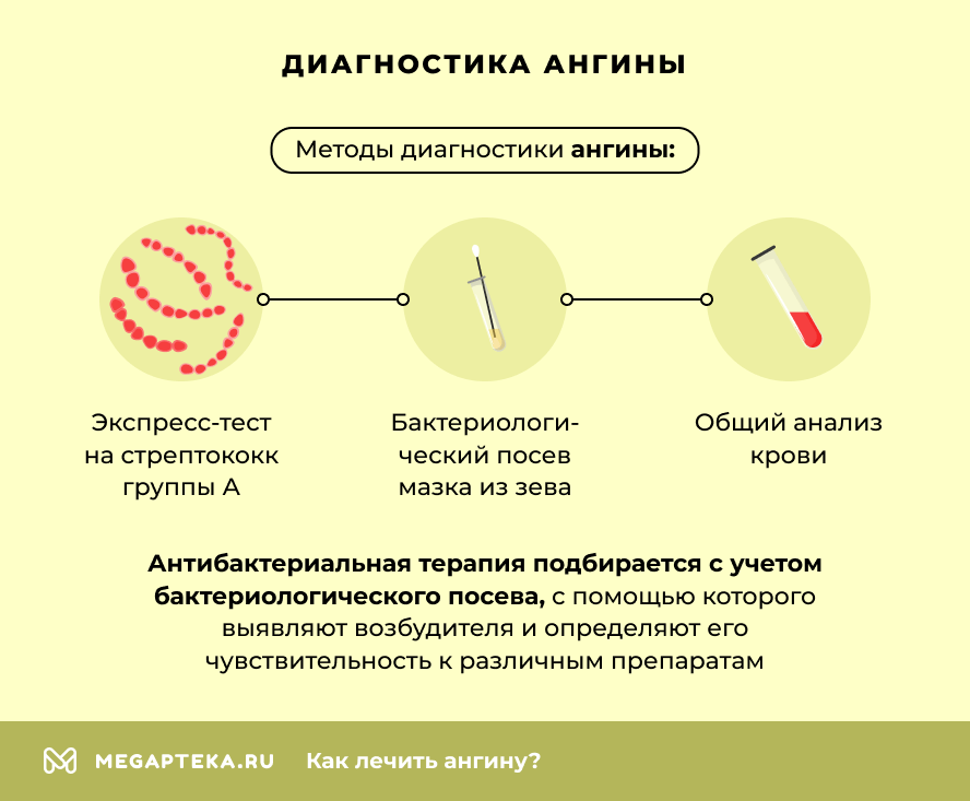 Диагностика ангины