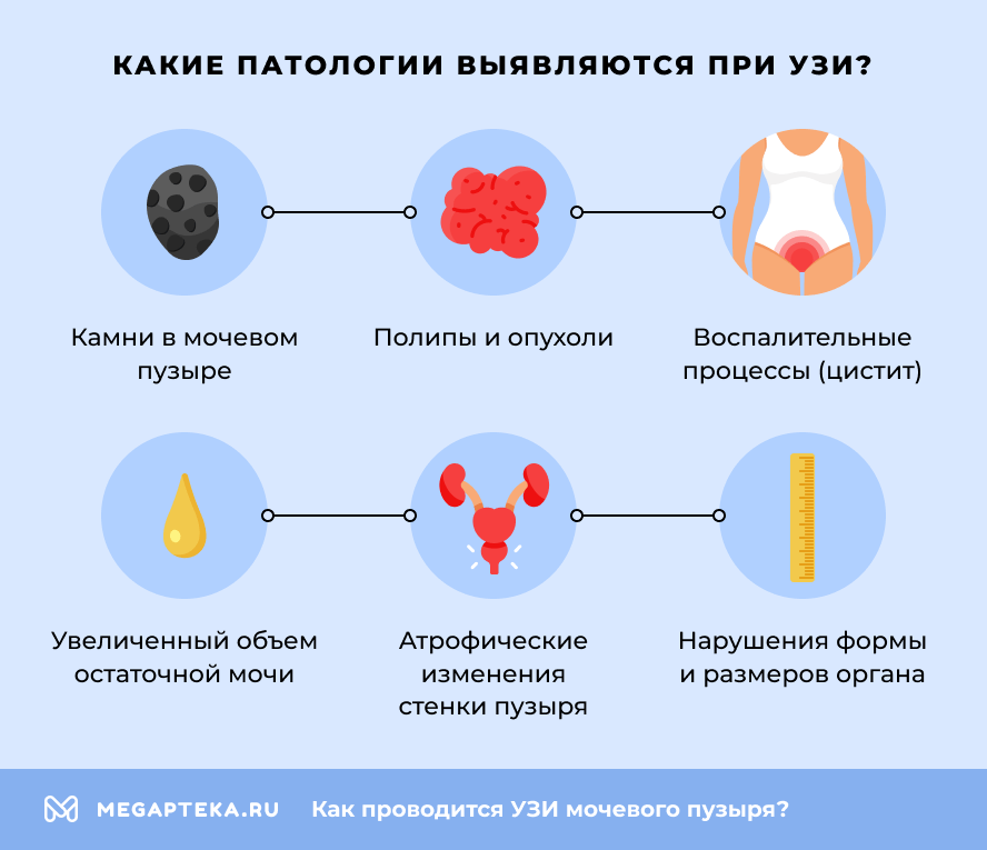Какие патологии выявляются при УЗИ?