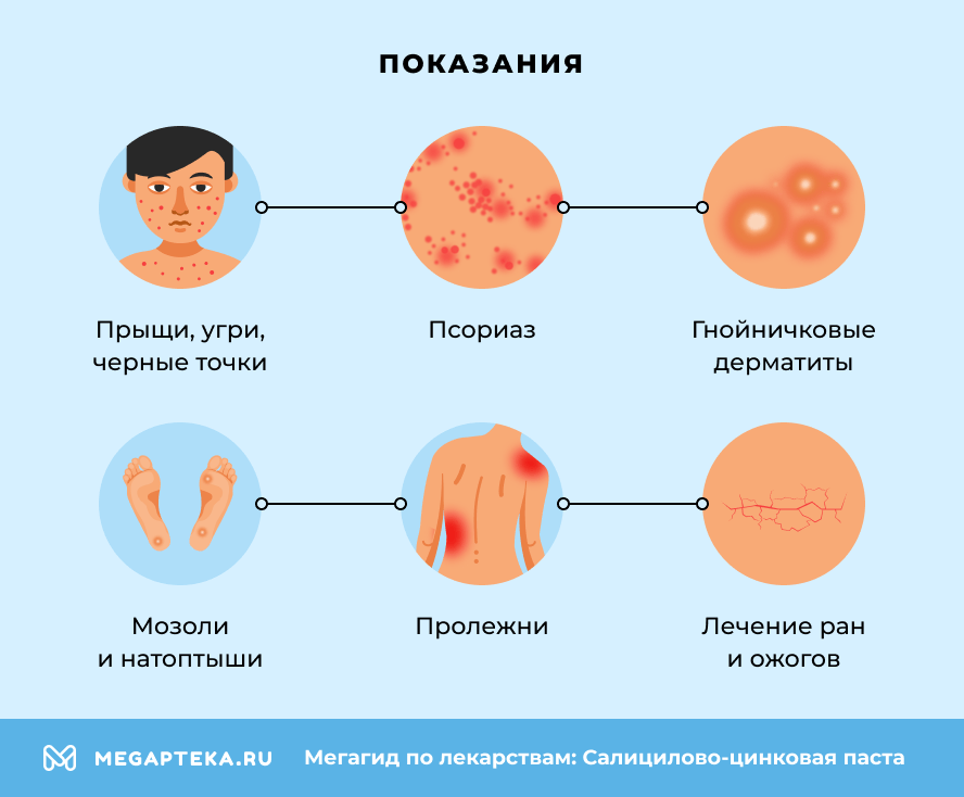 Показания