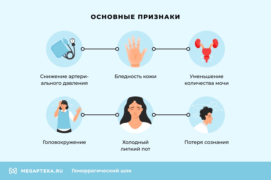 Основные признаки
