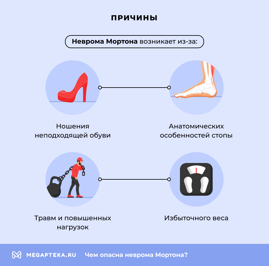 Причины