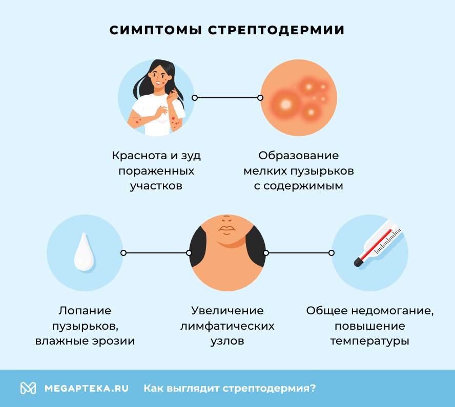 Симптомы стрептодермии