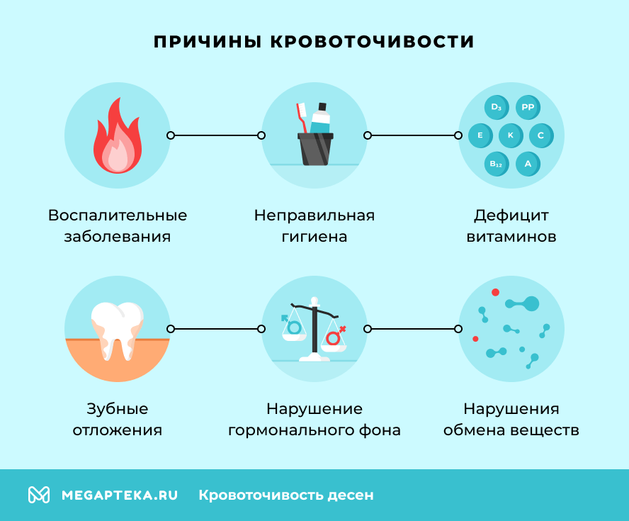 Причины кровоточивости