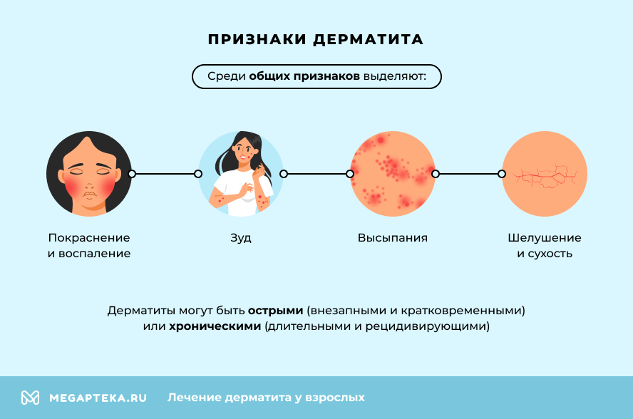 Признаки дерматита